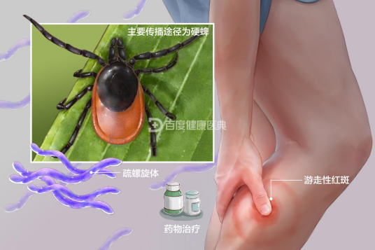 莱姆病