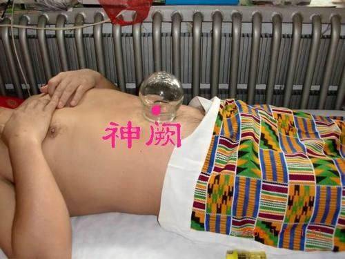 神阕穴