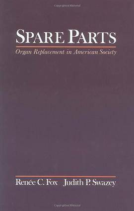 Spare Parts