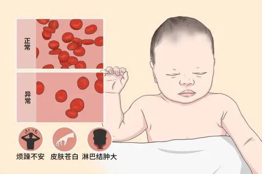 铁缺乏症