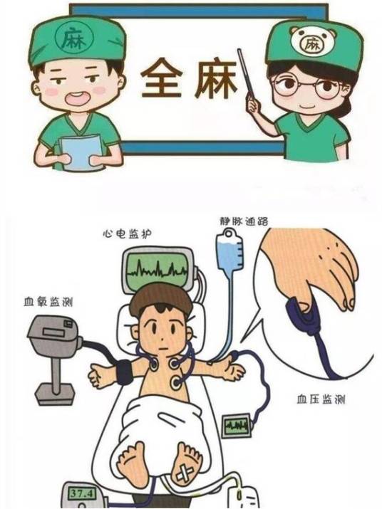 全身麻醉（医学术语）