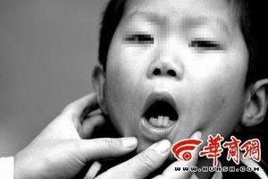 慢性铅中毒