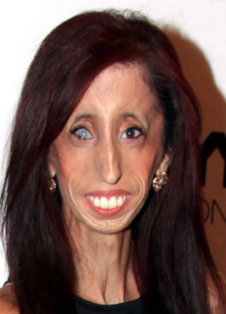 Lizzie Velasquez（演员、制作人）