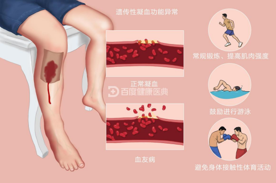 血友病