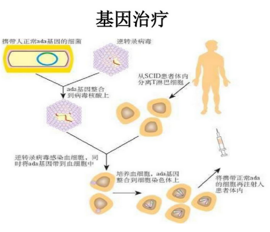基因疗法