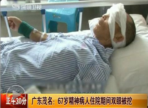 广东挖眼案